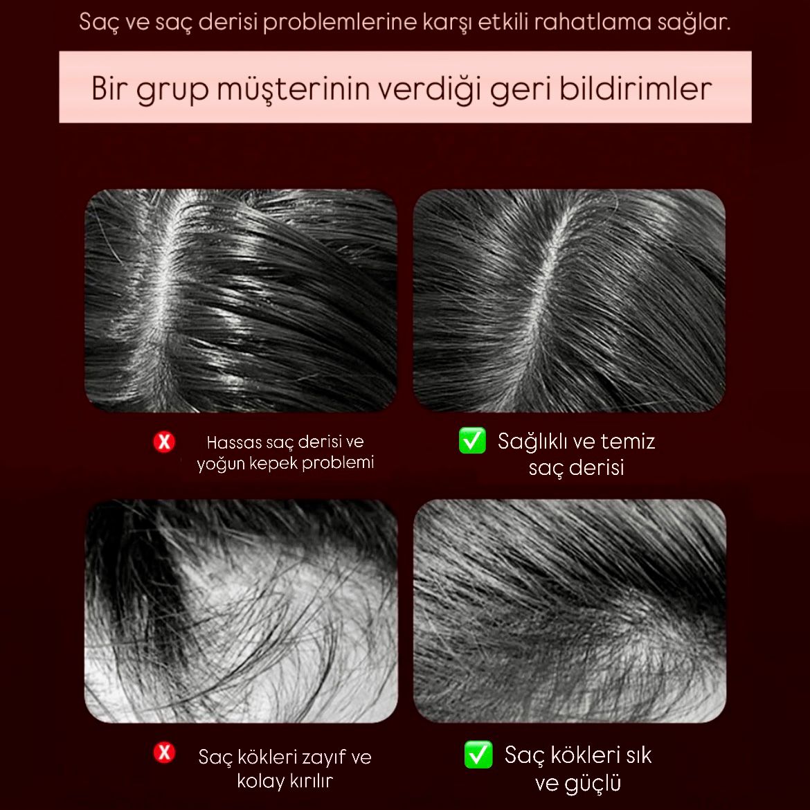 SAÇ DERİSİ MASAJ ALETİ